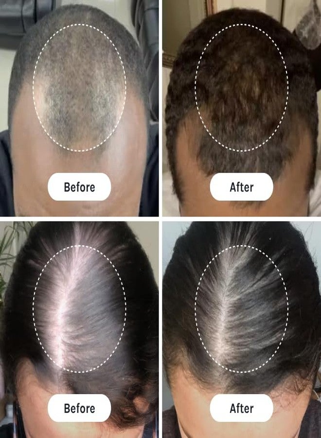 InfiniWell PTD-DBM Peptide Hair Serum for Fuller-Looking Hair - Scalp Treatment for Visible Growth & Follicle Renewal - Reinforce Restoration, Strand Integrity & Optimal Density (25 ml) - Image 5